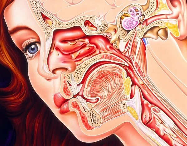 Artwork of ear, nose & throat in a cold sufferer