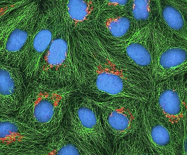 HeLa cells, light micrograph C017  /  8298