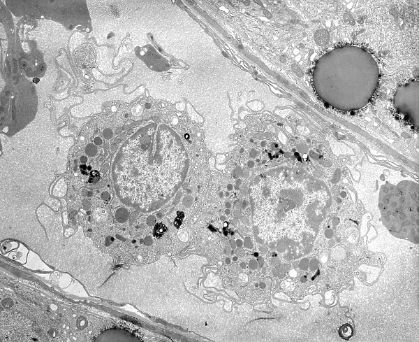 Macrophage white blood cells, TEM
