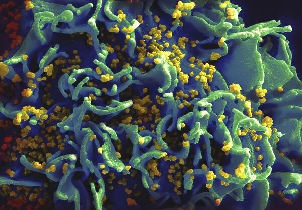 Scanning electron micrograph of HIV particles infecting a human T cell