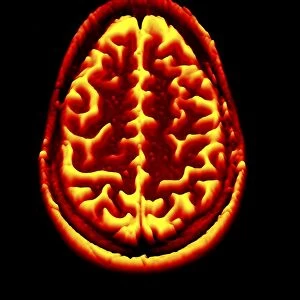 Brain scan, MRI scan, heightmap F006 / 7081