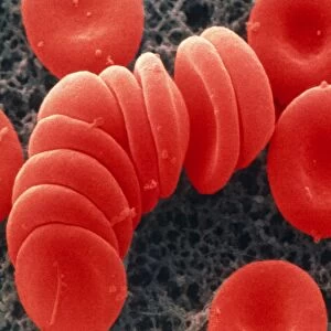 Coloured SEM of red blood cells, rouleau formation