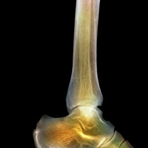 Healthy ankle, X-ray