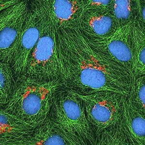 HeLa cells, light micrograph C017 / 8298