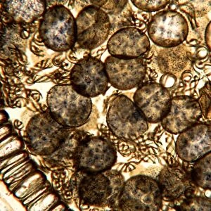 Liverwort spores, light micrograph